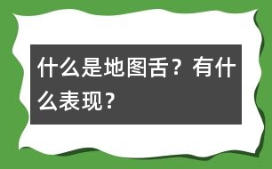 什么是地圖舌？有什么表現(xiàn)？