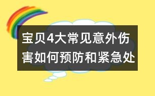 寶貝4大常見(jiàn)意外傷害如何預(yù)防和緊急處理