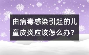 由病毒感染引起的兒童皮炎應(yīng)該怎么辦？