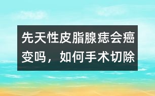 先天性皮脂腺痣會癌變嗎，如何手術(shù)切除