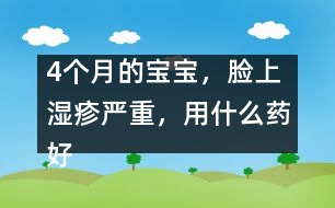 4個月的寶寶，臉上濕疹嚴(yán)重，用什么藥好