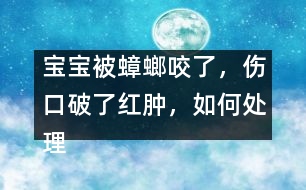 寶寶被蟑螂咬了，傷口破了紅腫，如何處理