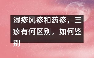 濕疹風(fēng)疹和藥疹，三疹有何區(qū)別，如何鑒別