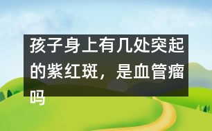 孩子身上有幾處突起的紫紅斑，是血管瘤嗎