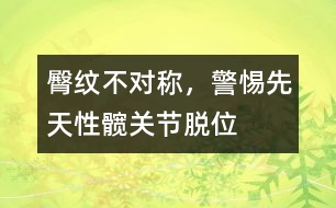 臀紋不對稱，警惕先天性髖關(guān)節(jié)脫位