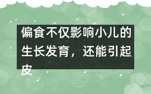 偏食不僅影響小兒的生長發(fā)育，還能引起皮膚病